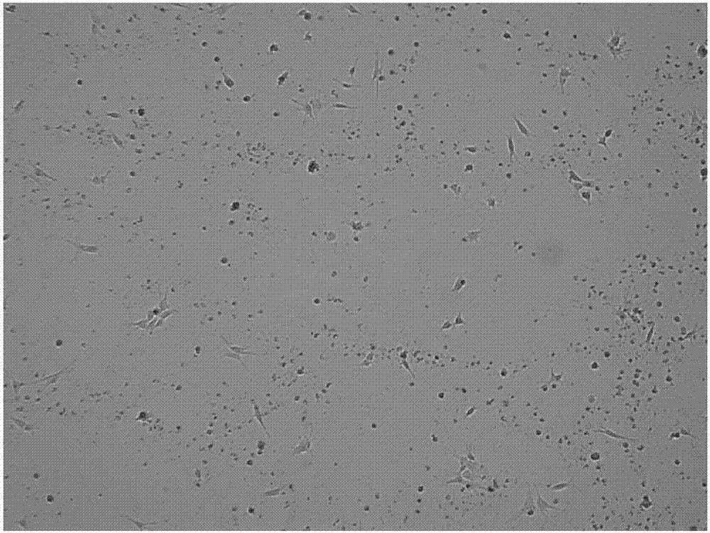 Culture method for Schwann cells