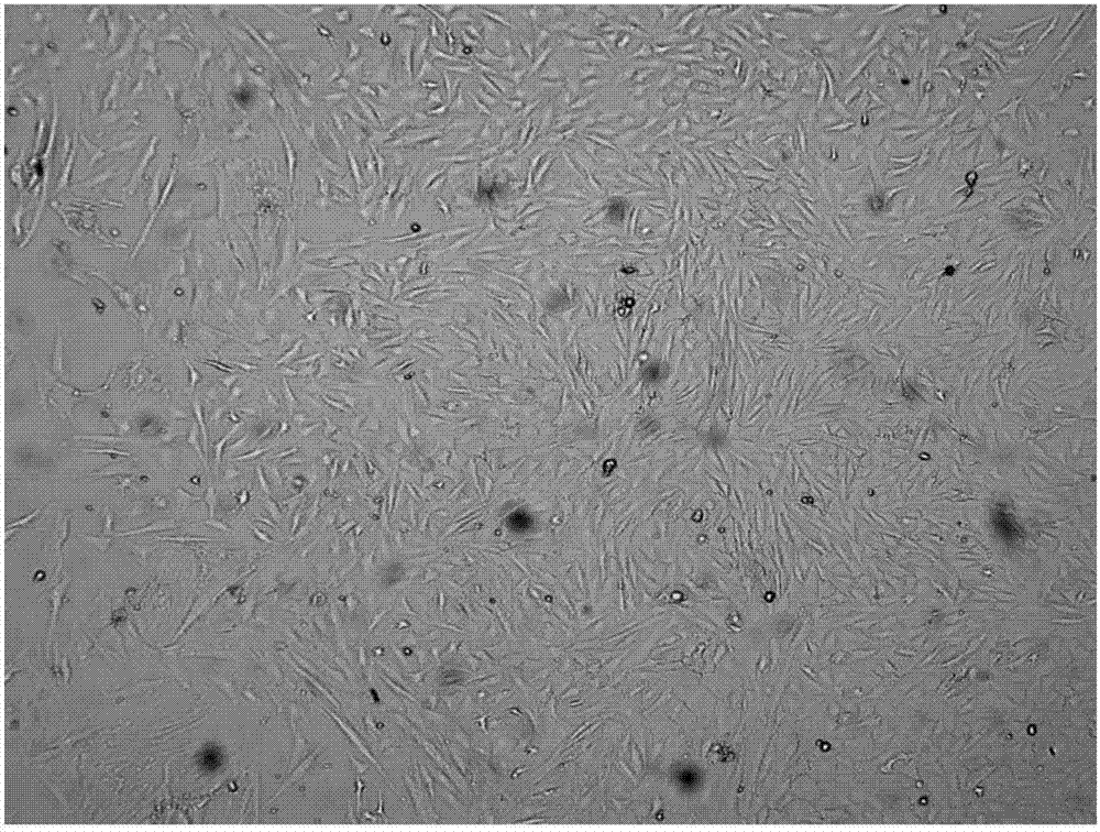 Culture method for Schwann cells