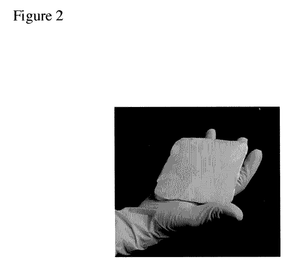 Gelatin-transglutaminase hemostatic dressings and sealants