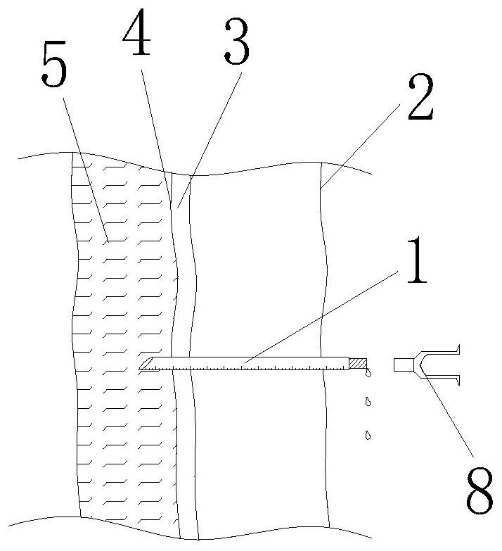 Implementation method of novel combined spinal-epidural anesthesia puncture suite