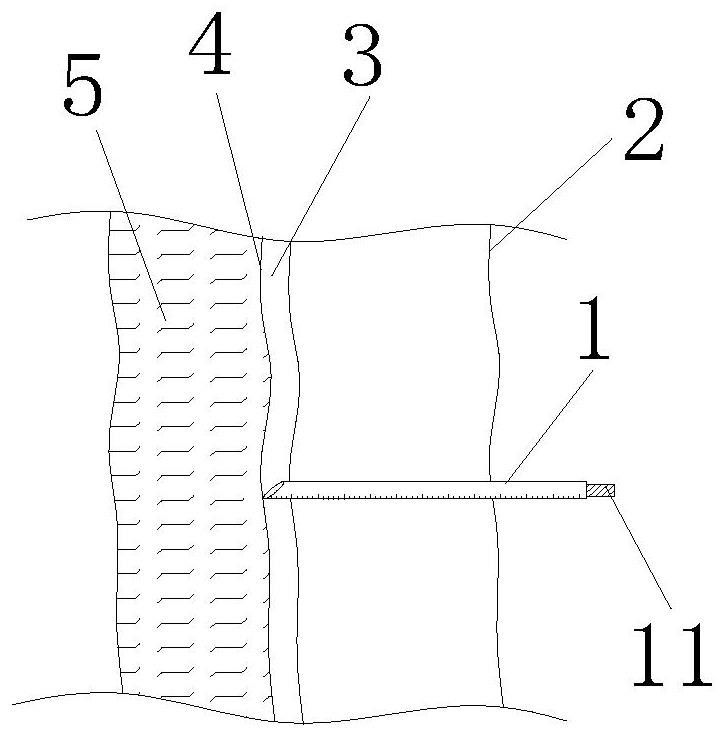 Implementation method of novel combined spinal-epidural anesthesia puncture suite