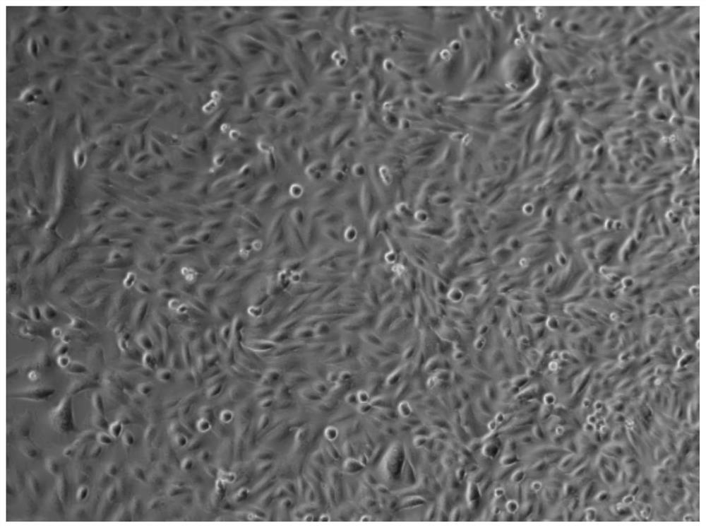 CD24 positive expression cell in urine as well as preparation method and application of CD24 positive expression cell