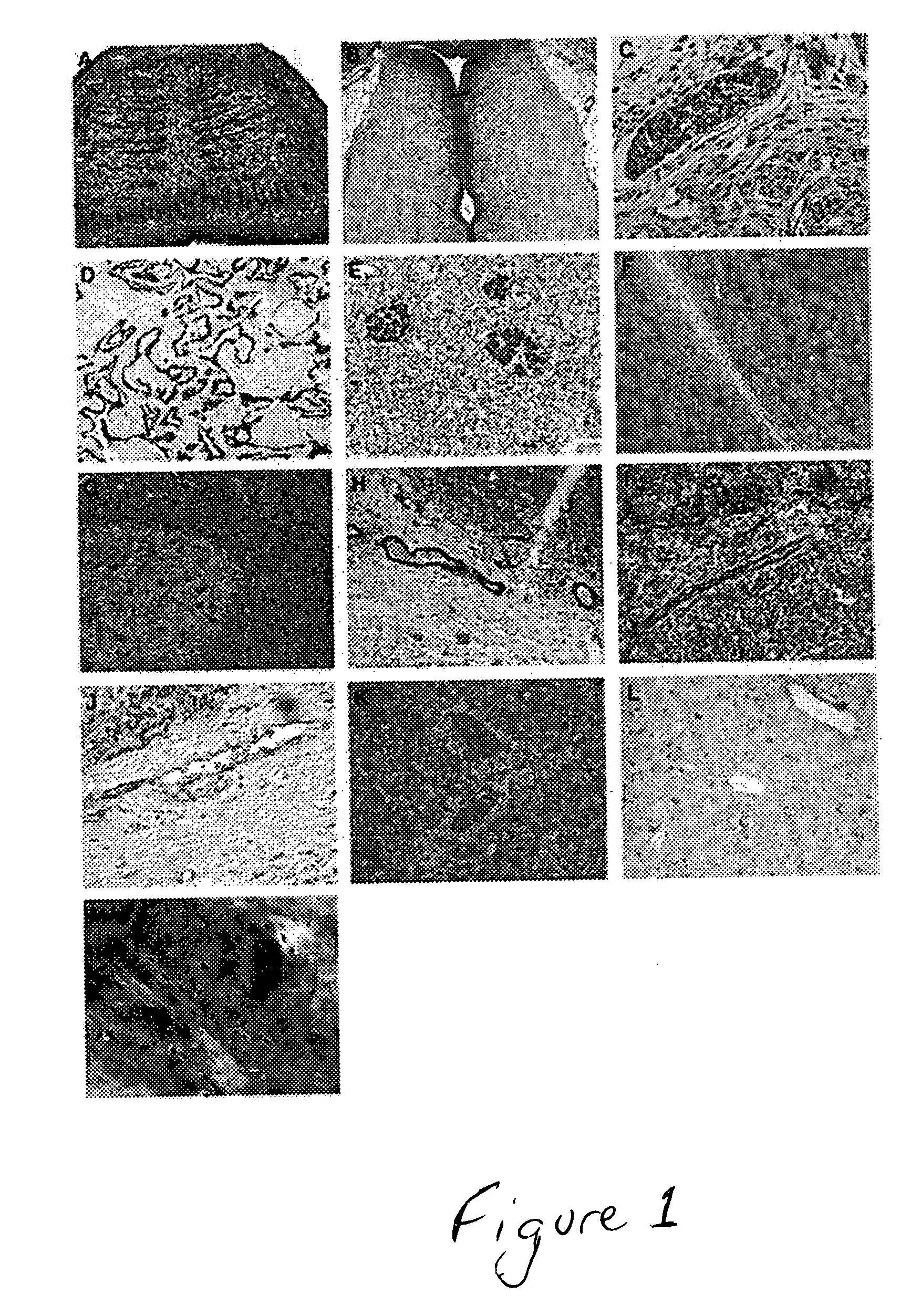 Engineering three-dimensional tissue structures using differentiating embryonic stem cells