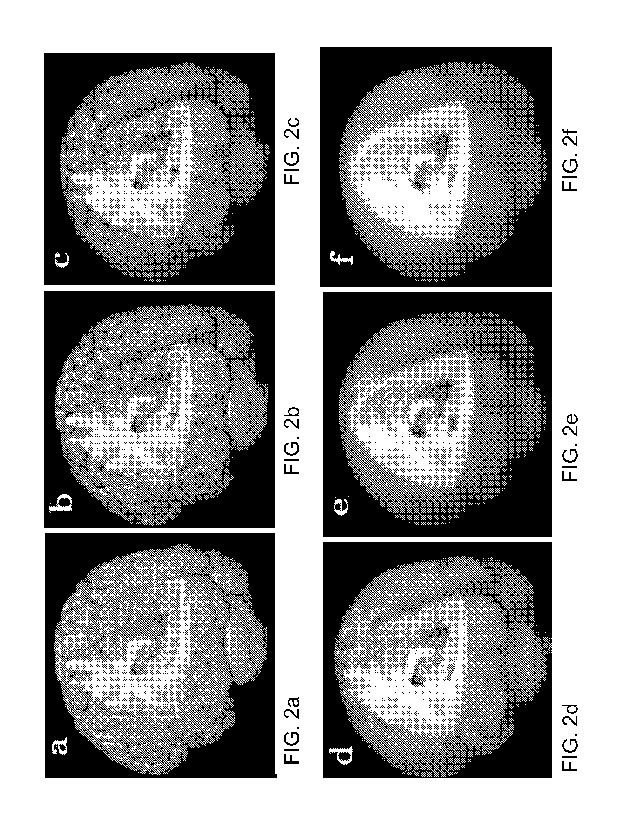 Method and system for analysis of volumetric data