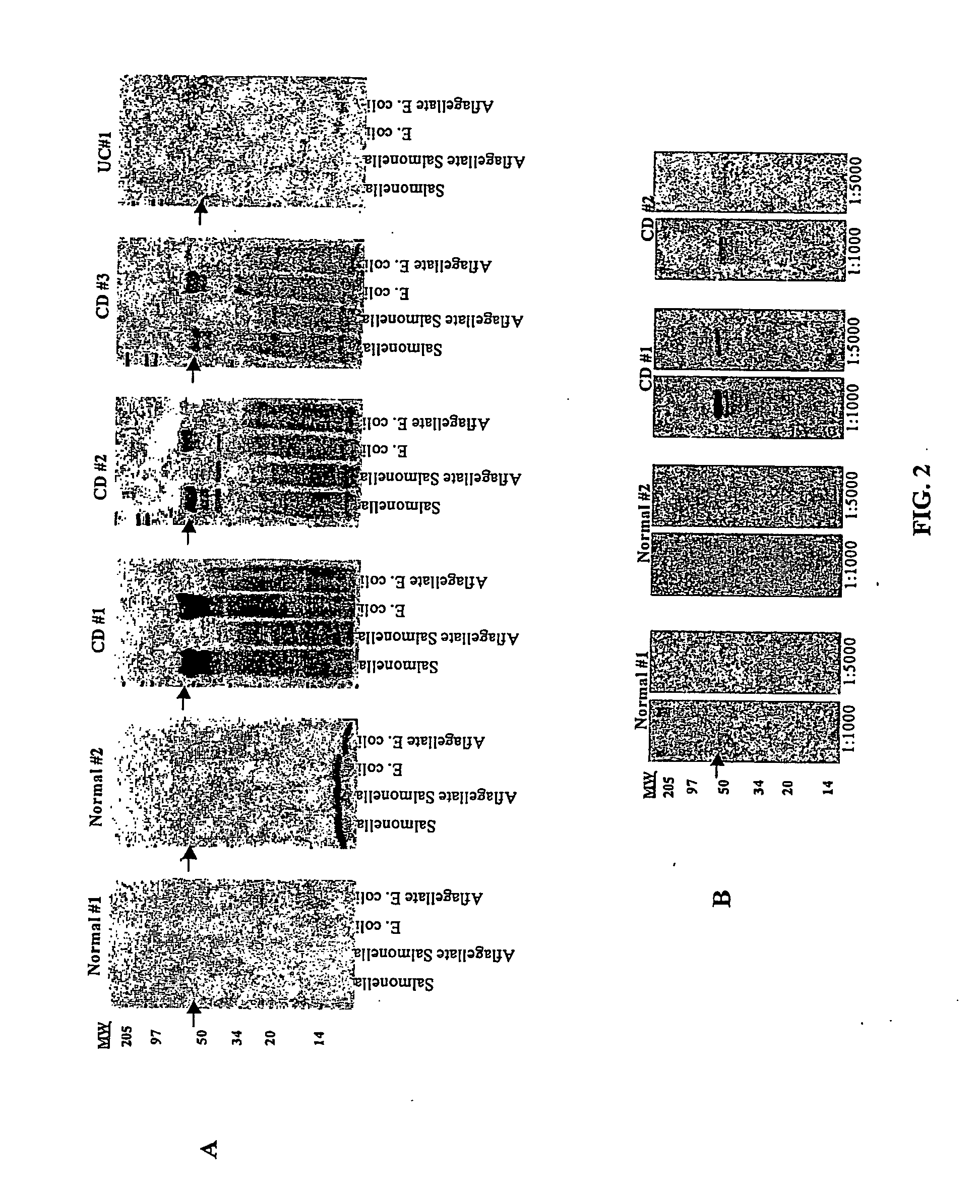 Diagnostic Tests and Methods for Diagnosing Inflammatory Bowel Disease