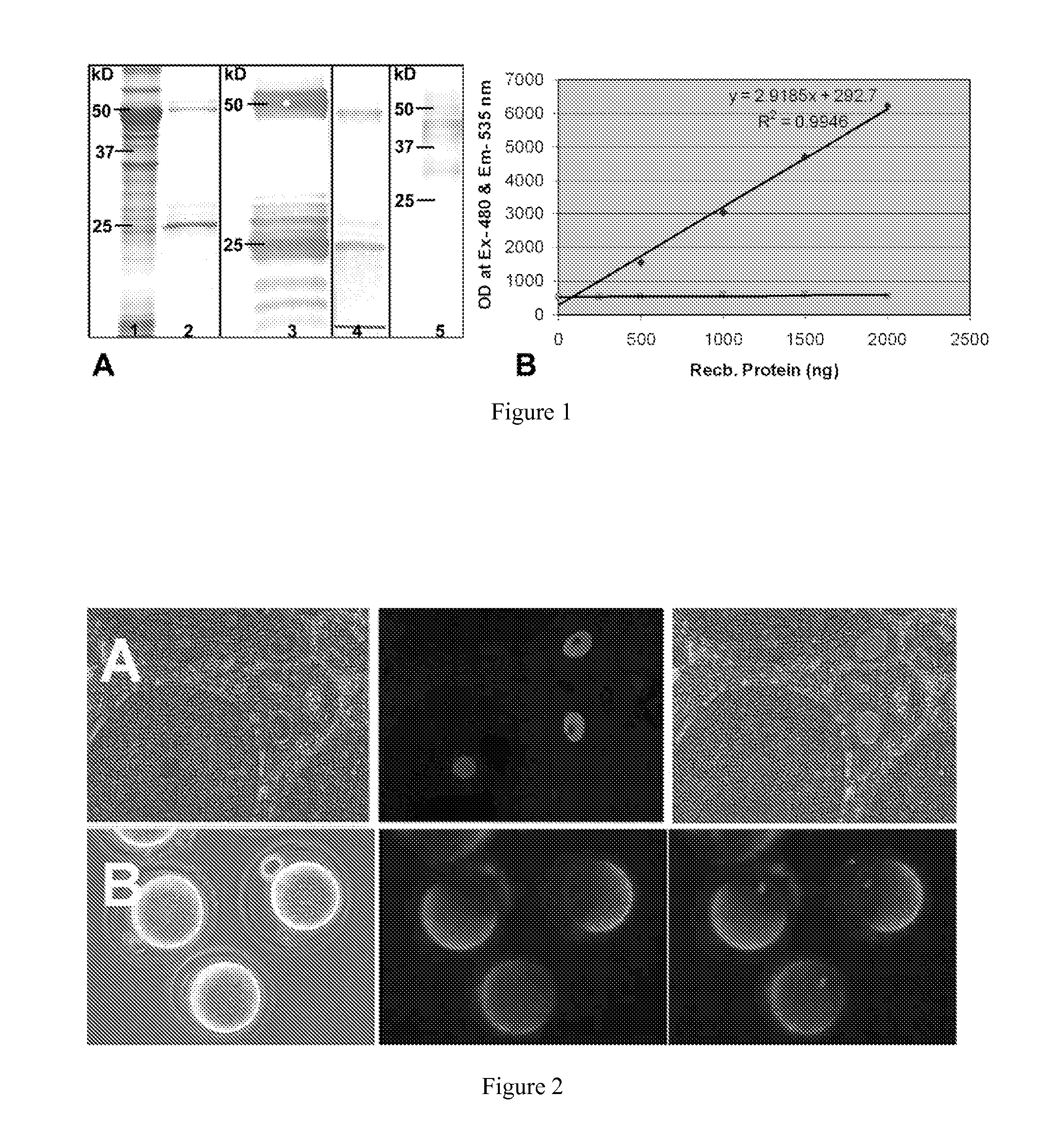 Compositions and methods for regulating sas1r