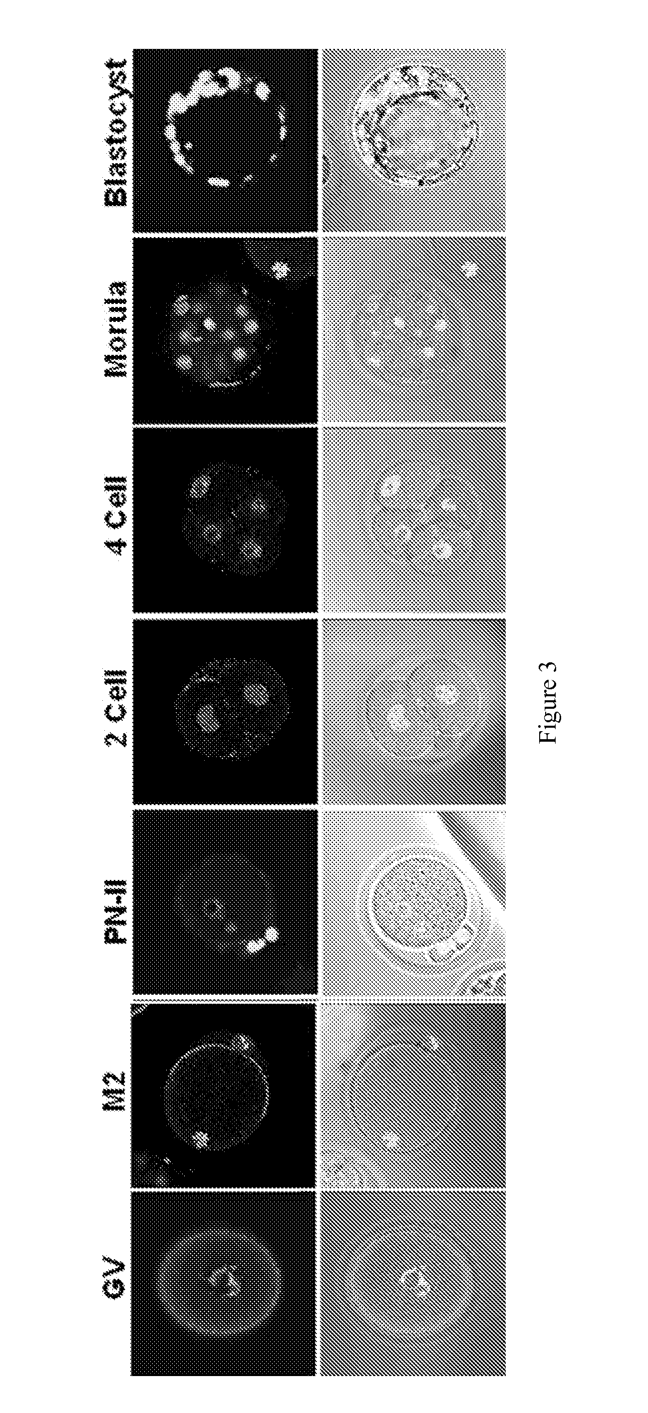 Compositions and methods for regulating sas1r