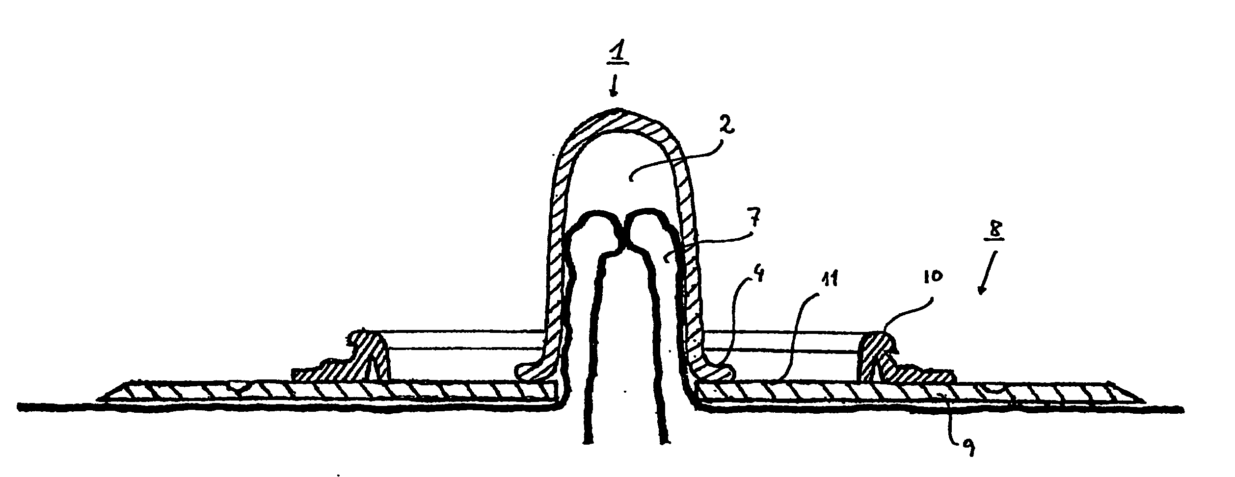 Ostomy sealing device