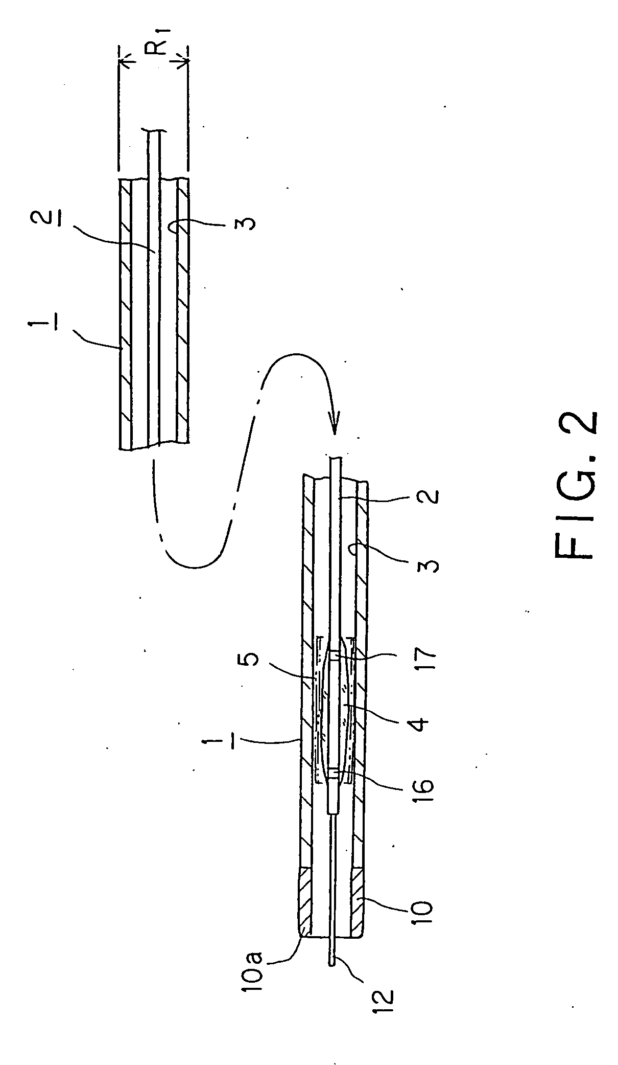 Stent supplying device