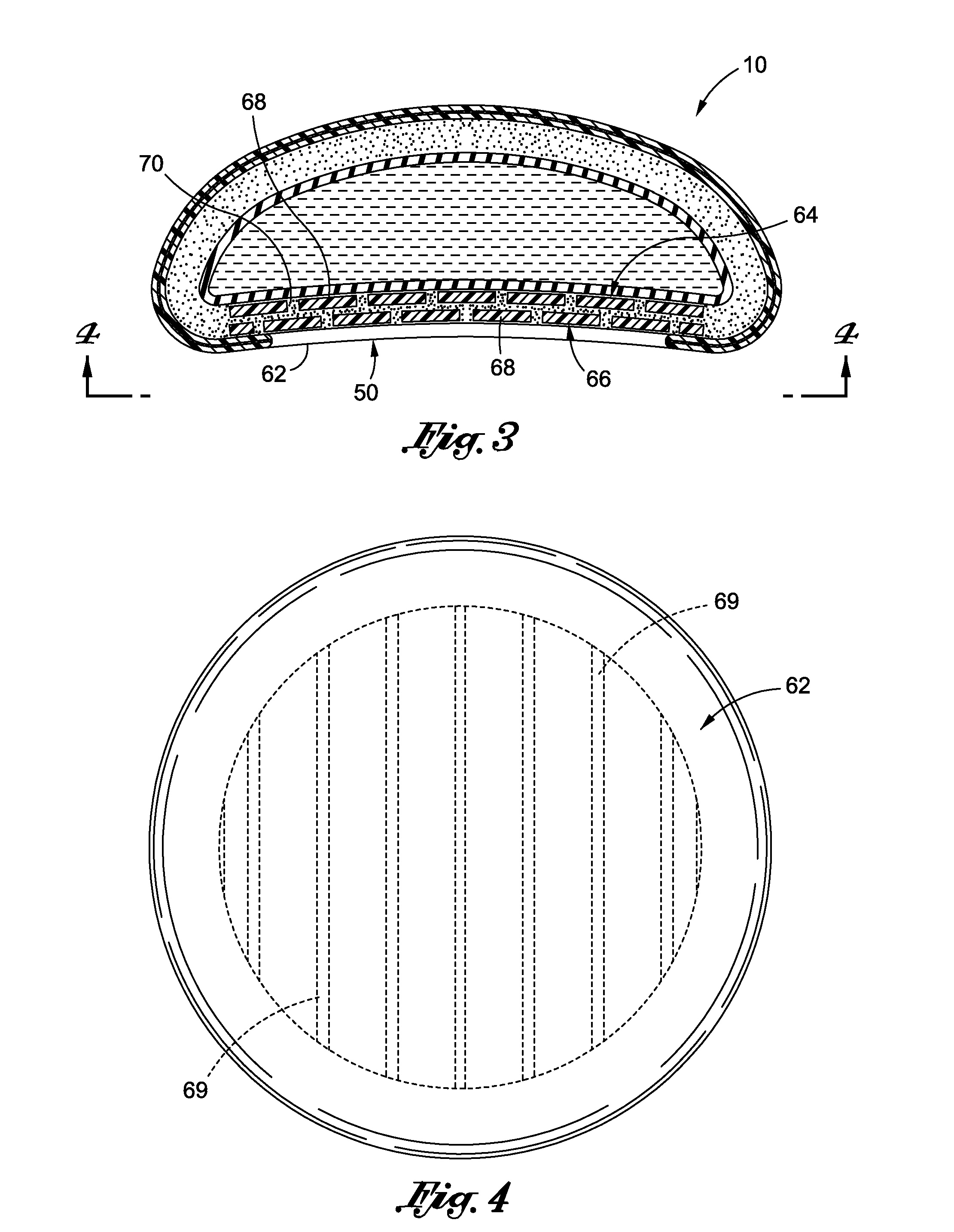 Inflatable prostheses and methods of making same