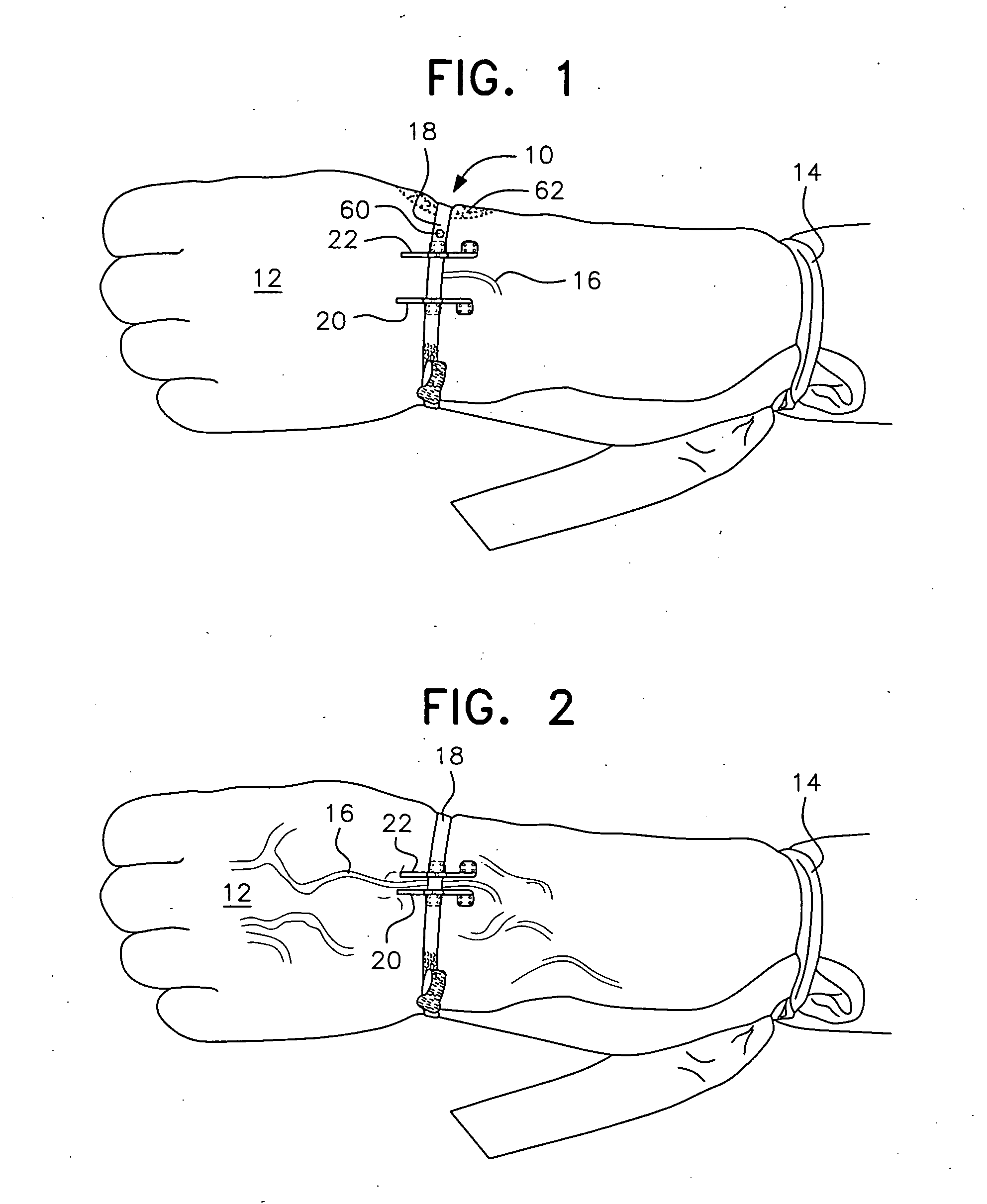 Vein Stabilizer