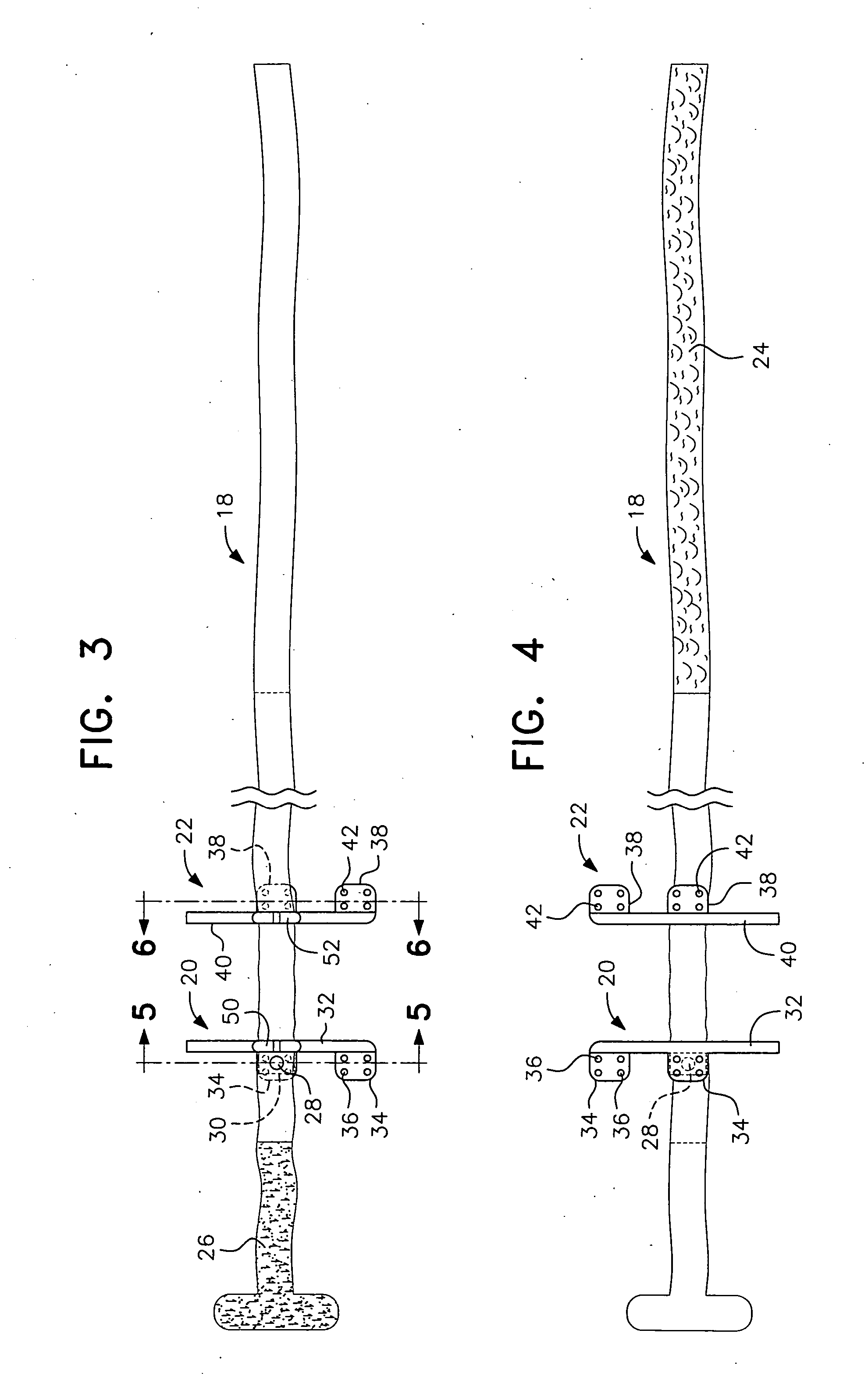 Vein Stabilizer