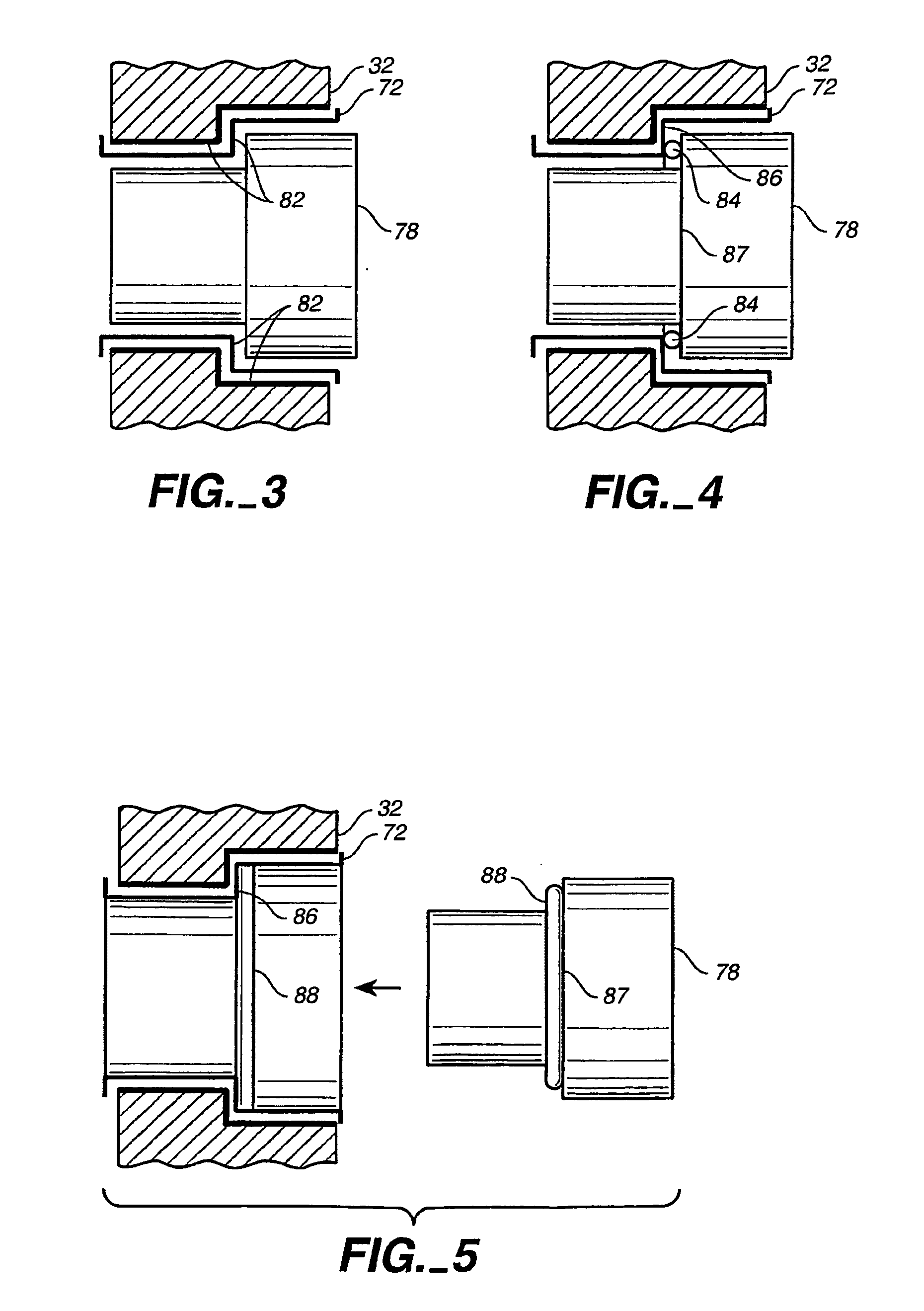 Cochlear fenestration burrs