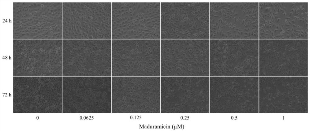 Application of maduramicin ammonium in preparation of anti-breast cancer drugs