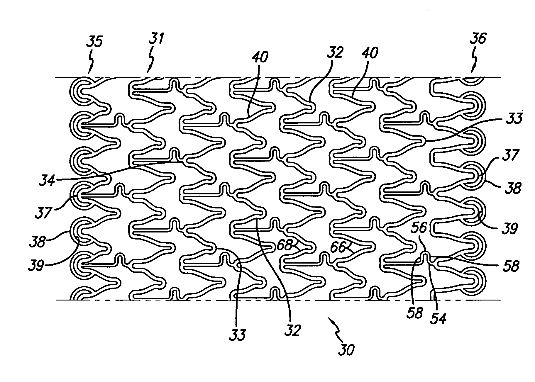 Intravascular stent with extendible end rings