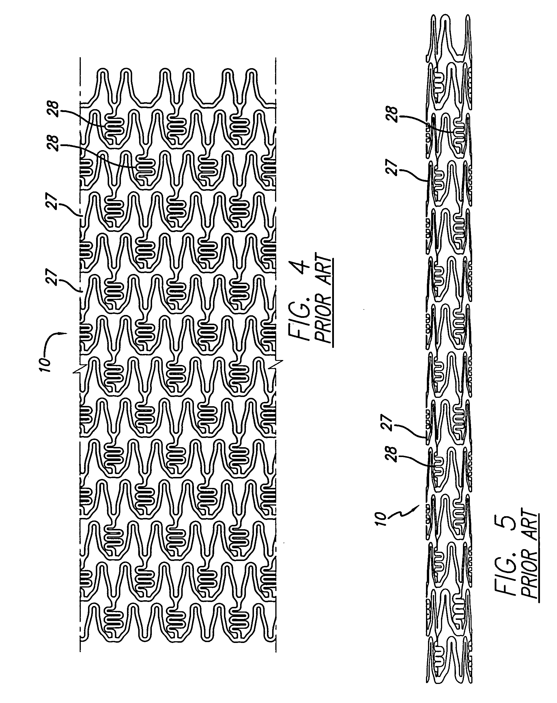 Intravascular stent with extendible end rings