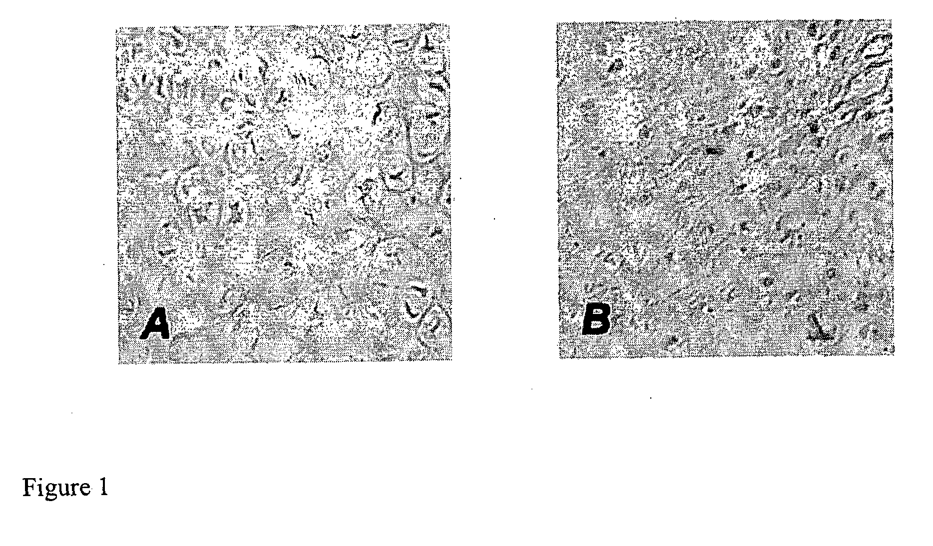 Compositions and Methods that Enhance Articular Cartilage Repair