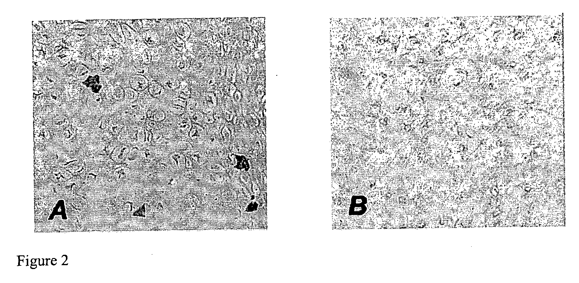 Compositions and Methods that Enhance Articular Cartilage Repair