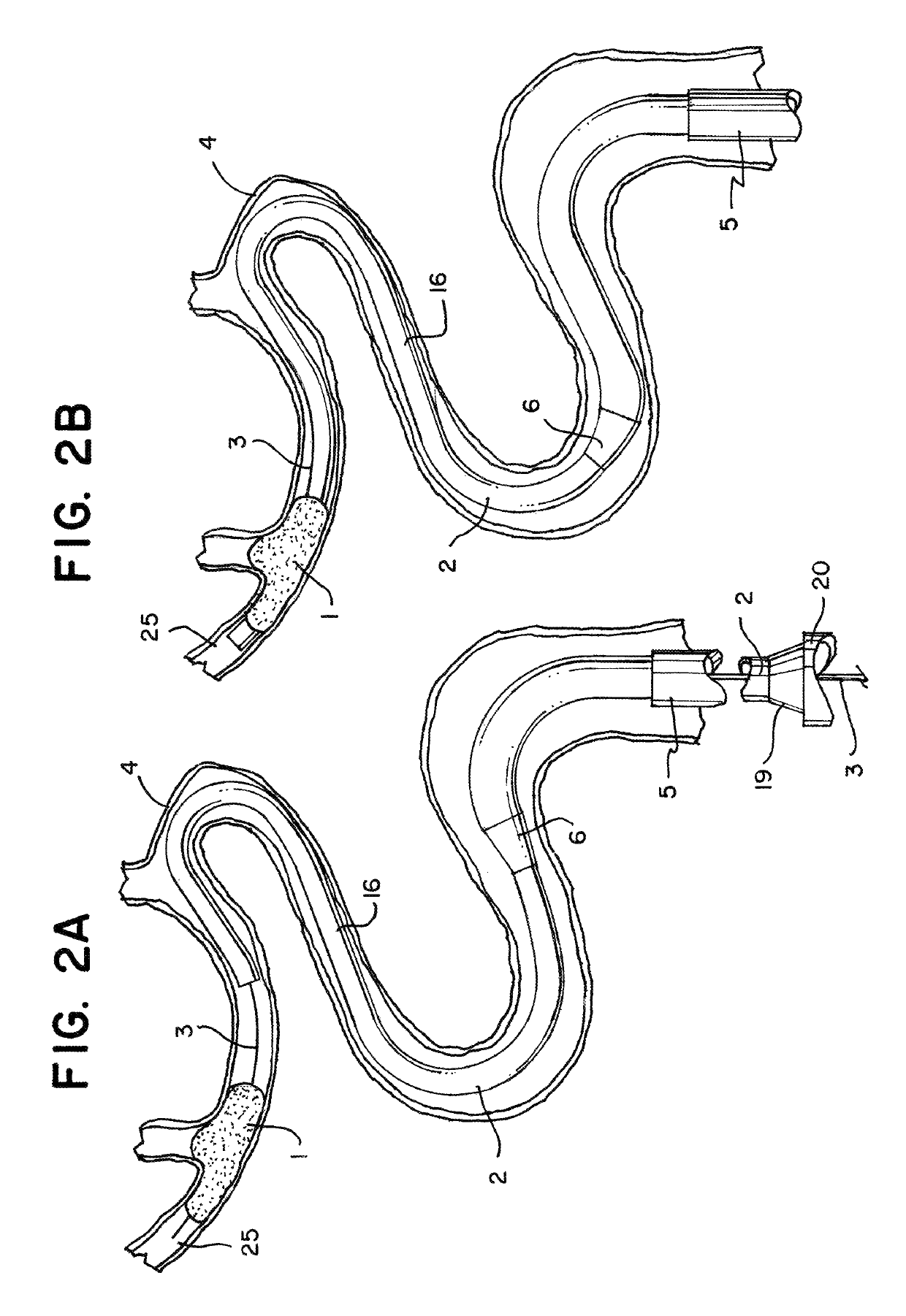 System for removing a clot from a blood vessel