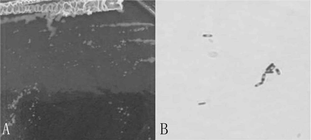 Preparation method of high-yielding acetoin and aroma-enhancing Bacillus mohaiwei direct-throwing starter and its application in the production of Shanxi aged vinegar