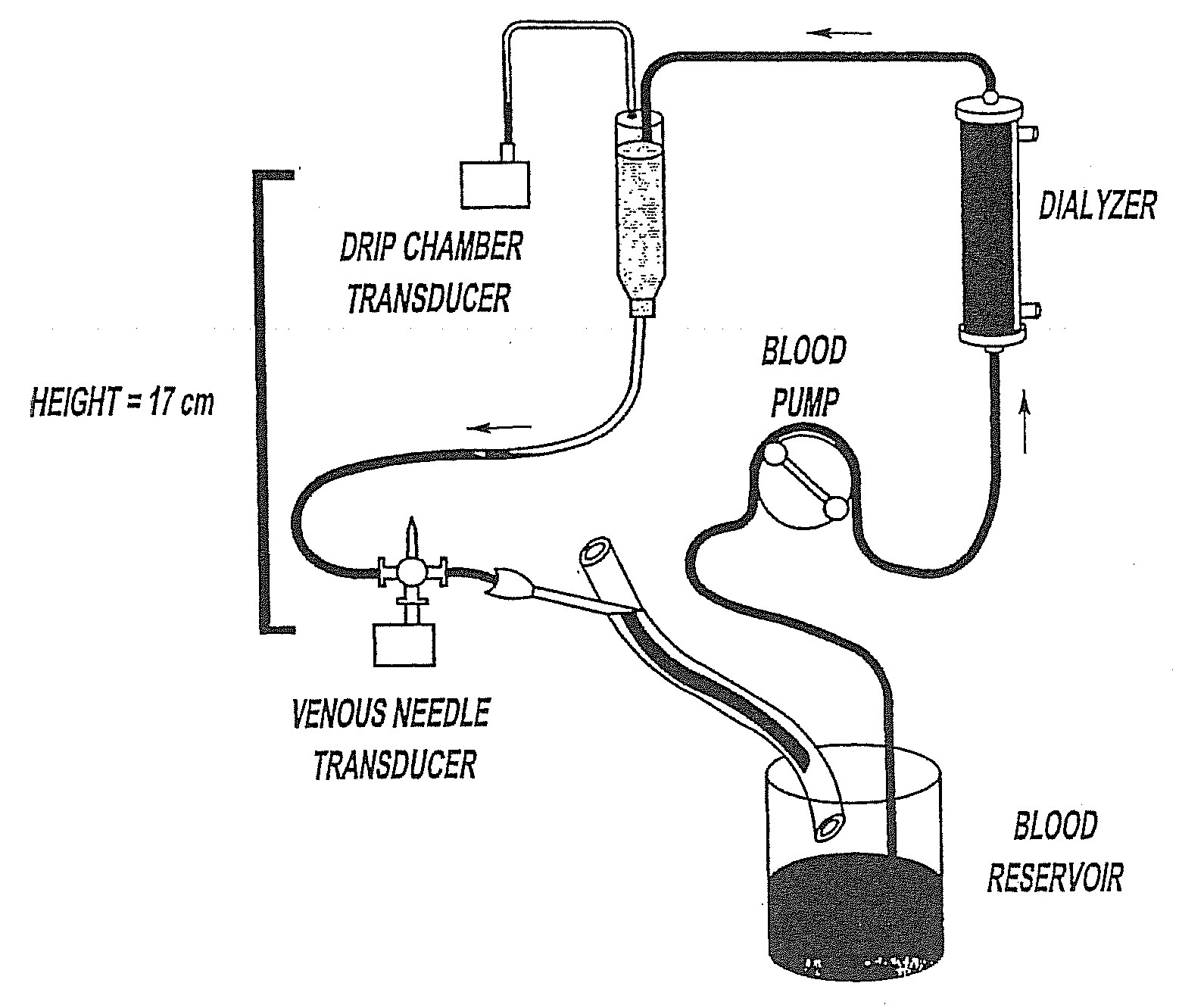 Method of Monitoring Dislodgement of Venous Needles in Dialysis Patients