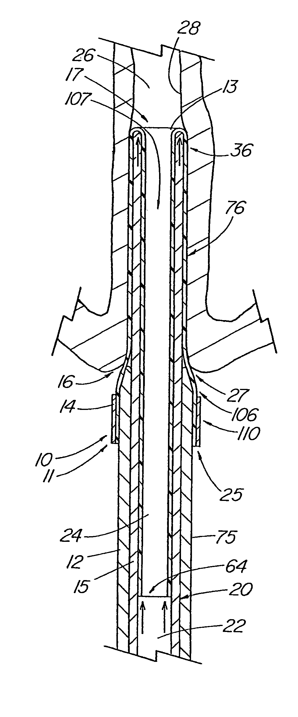 Introducer apparatus with eversible sleeve