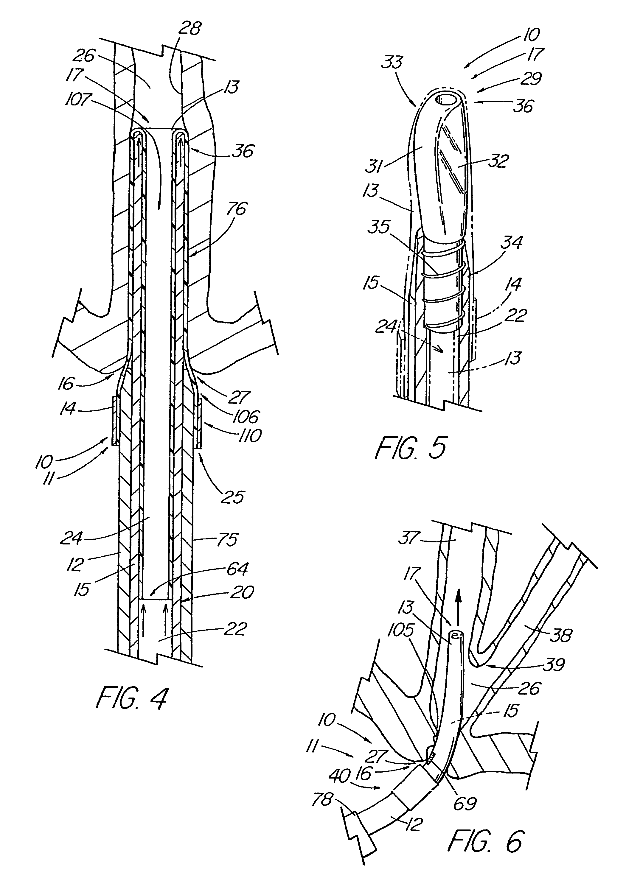 Introducer apparatus with eversible sleeve