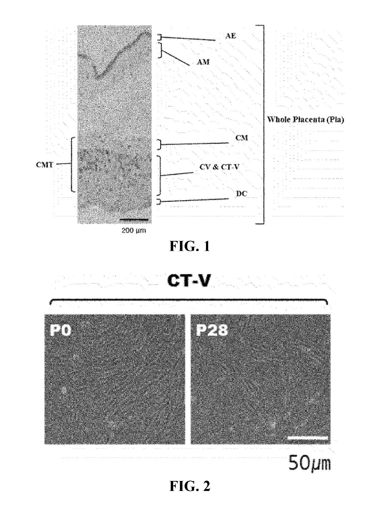 Stem Cells Derived from Pure Chorionic Trophoblast Layer and Cell Therapy Comprising Same