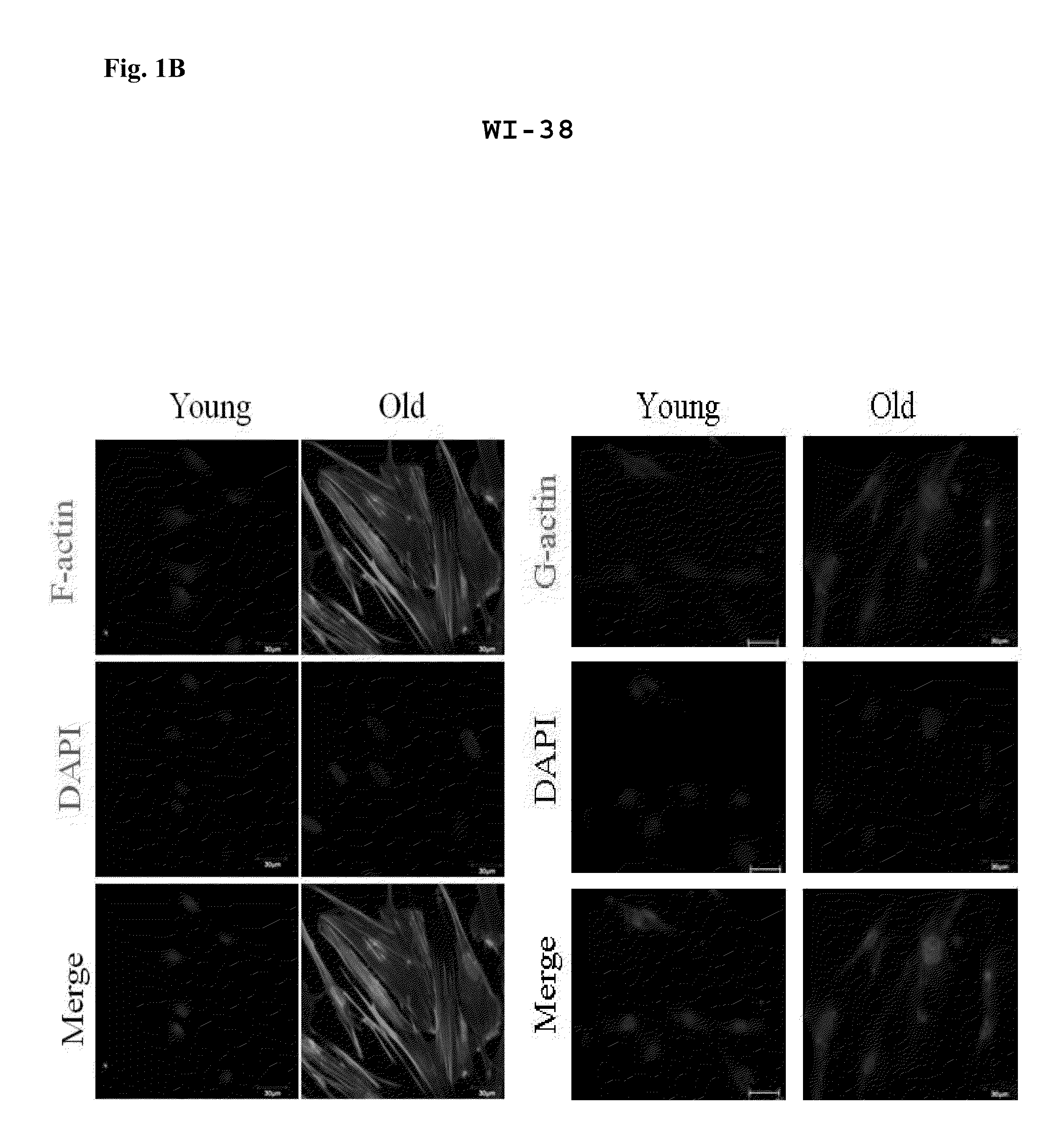 Method for evaluating cell aging by expression level of cofilin