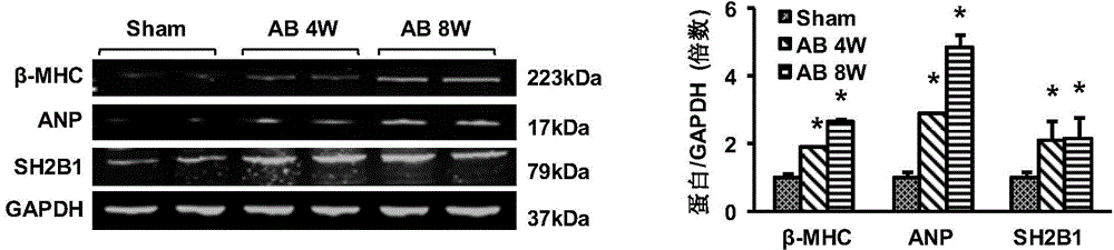 Function and application of SH2B adapter protein 1 (SH2B1) in myocardial hypertrophy treatment