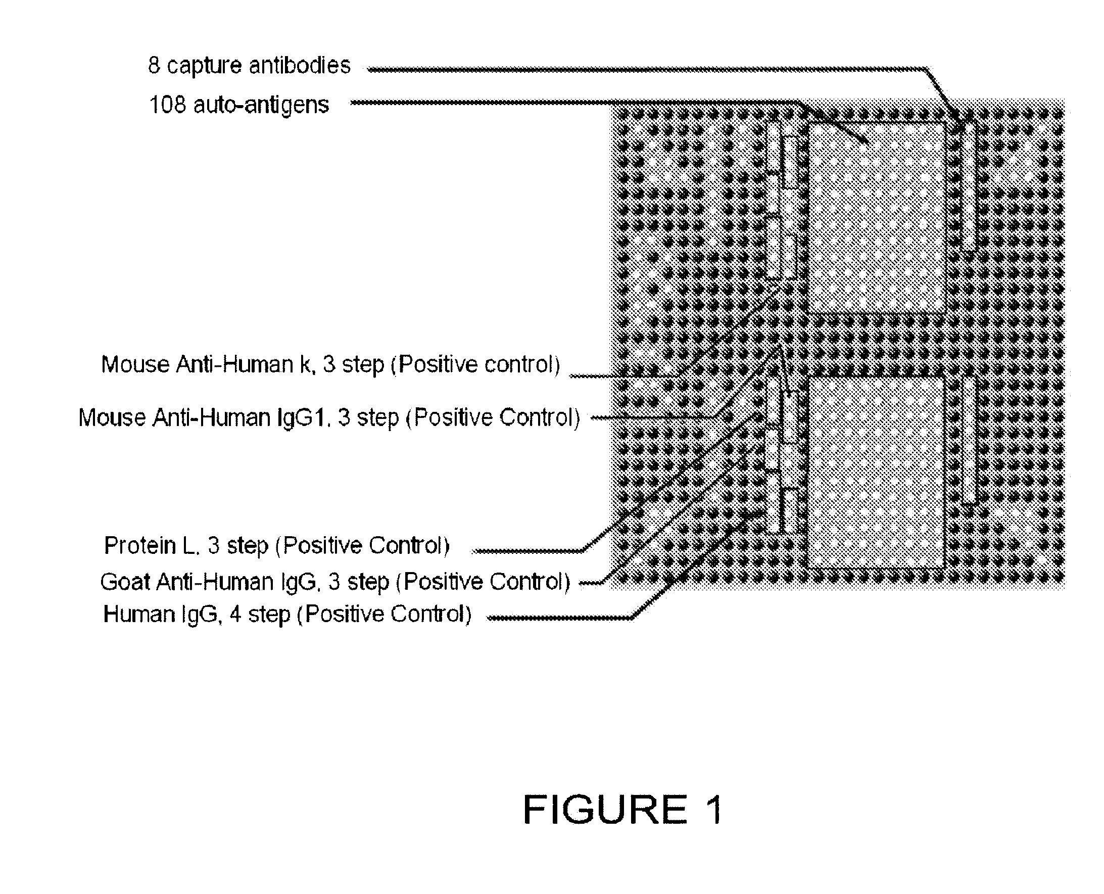 Methods and kits for detecting prostate cancer biomarkers