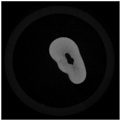 Low-dose CT tooth image denoising method based on double-residual network