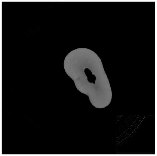 Low-dose CT tooth image denoising method based on double-residual network