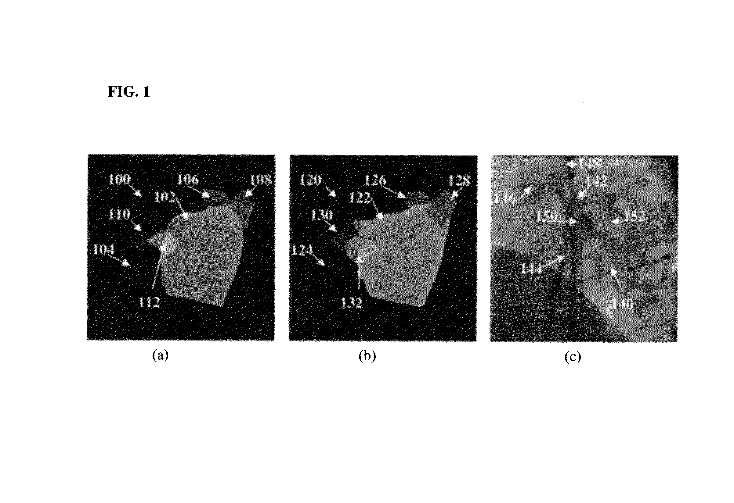 Method and system for multi-part left atrium segmentation in C-arm computed tomography volumes using shape constraints