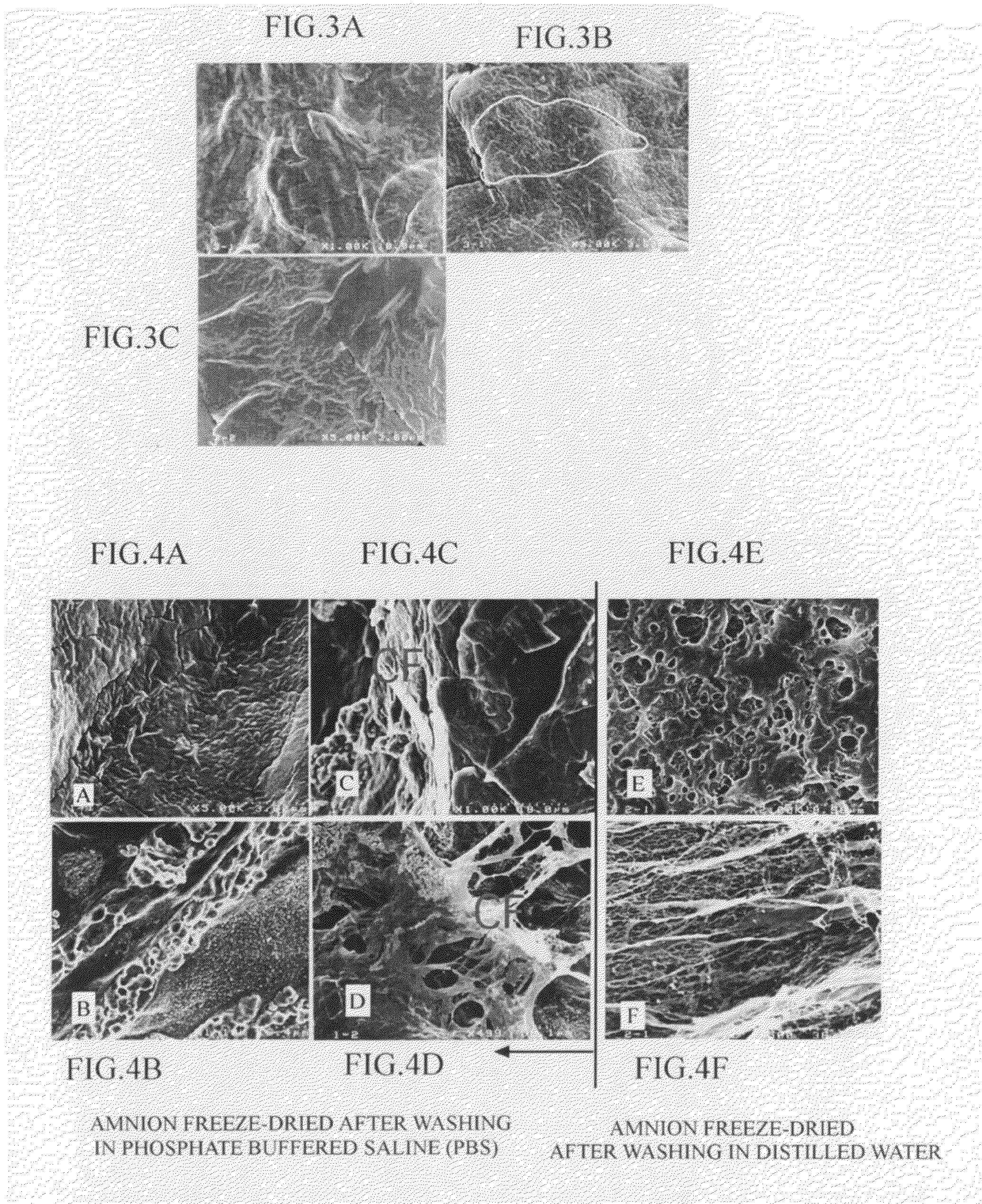 Dried amnion and method for drying teatment of amnion