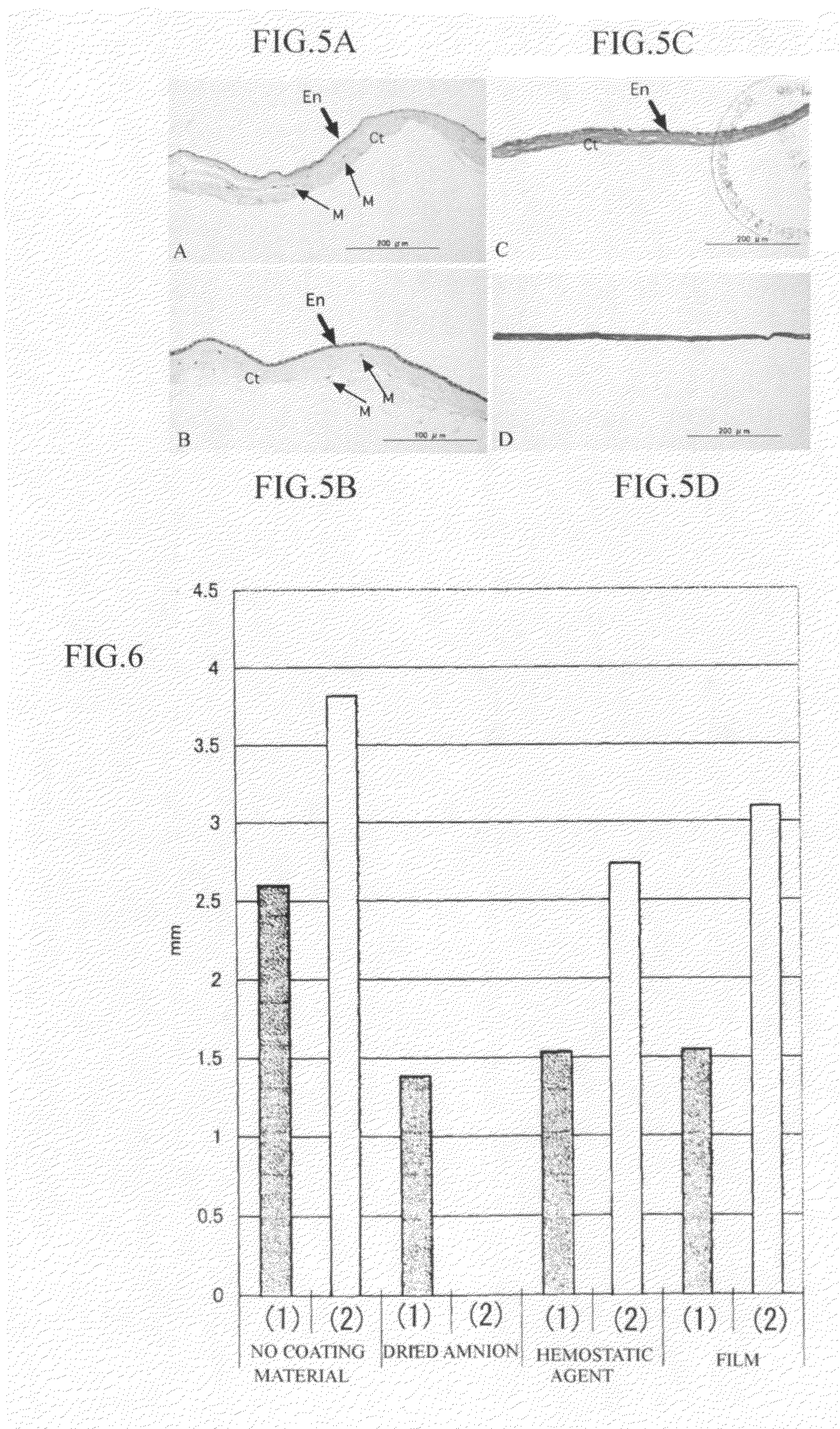 Dried amnion and method for drying teatment of amnion