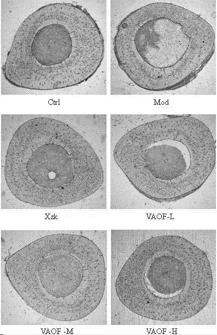 Application of compound traditional Chinese medicine in prevention and treatment of osteoporosis disease