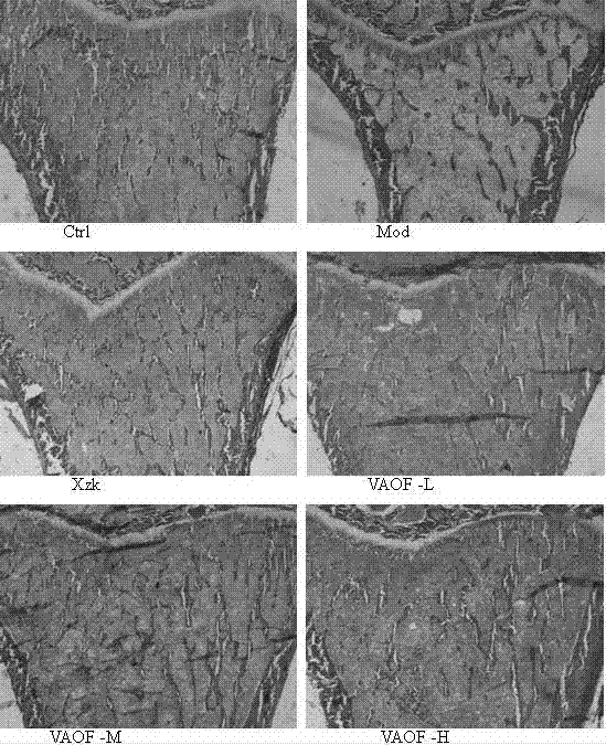 Application of compound traditional Chinese medicine in prevention and treatment of osteoporosis disease