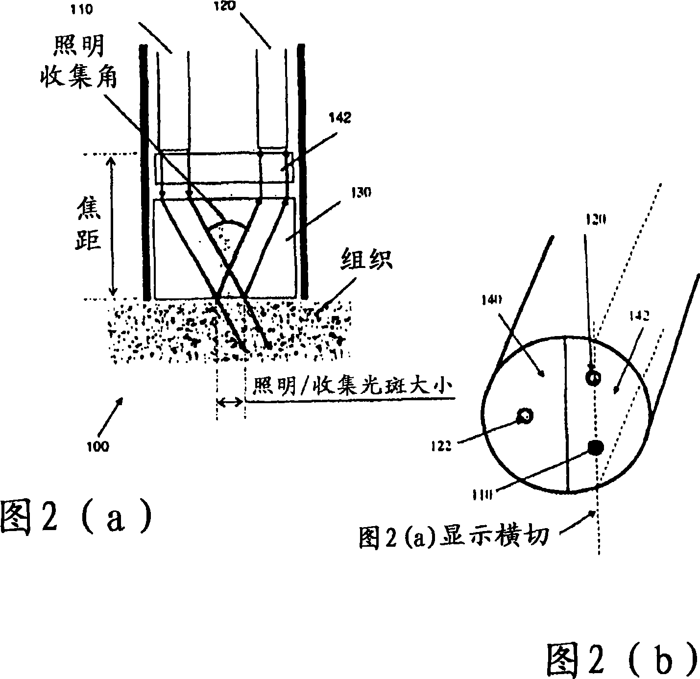 Method and apparatus for recognizing abnormal tissue using the detection of early increase in microvascular blood content