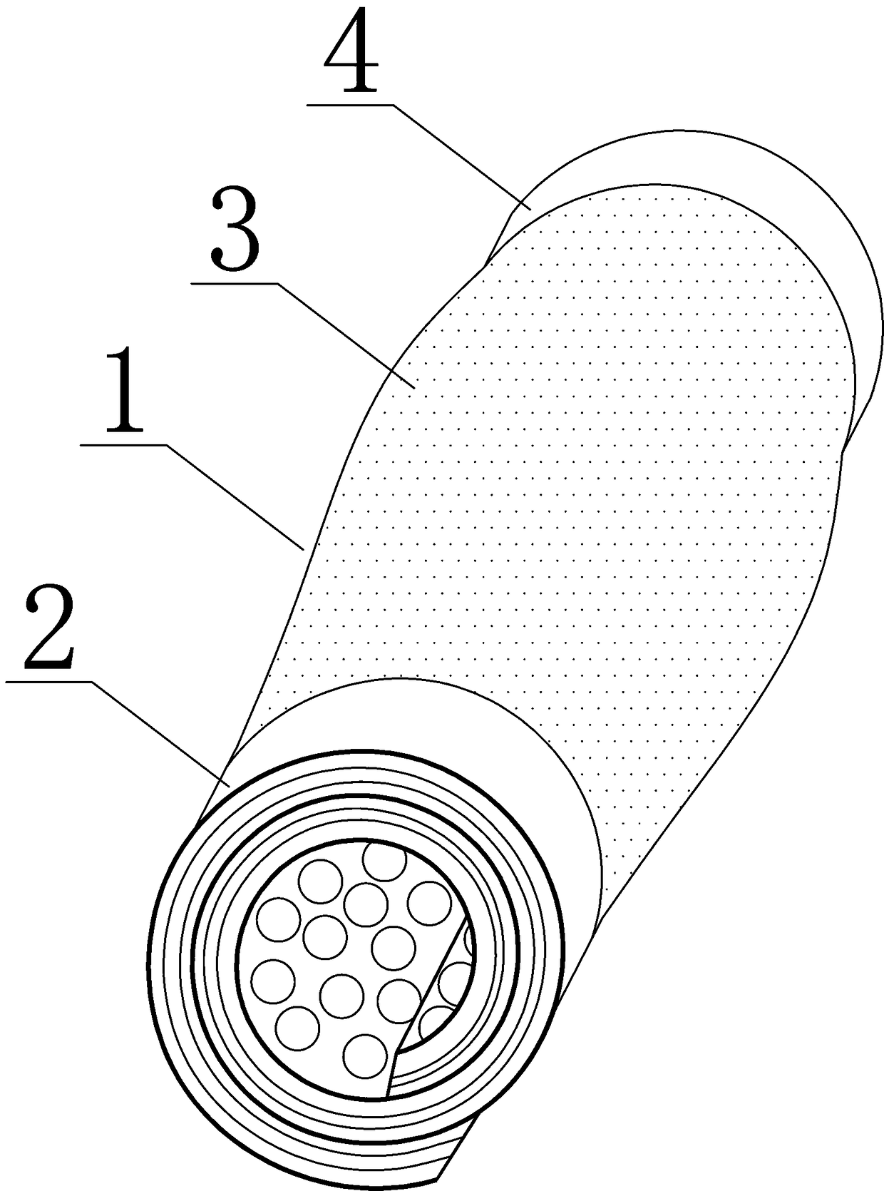 Medical oversleeve with automatic winding function