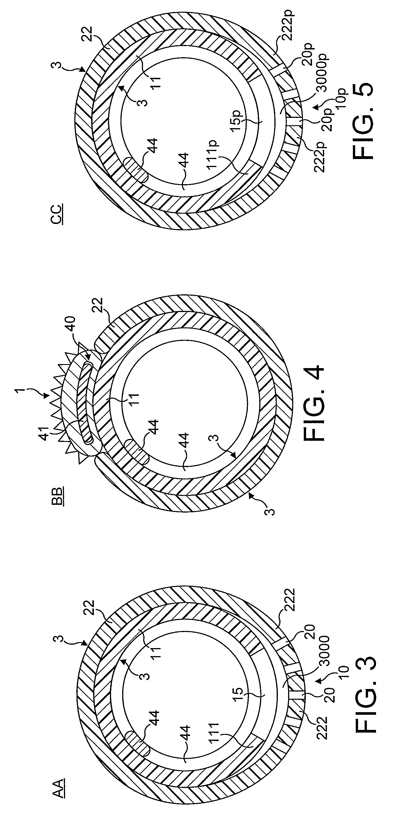 Rotational atherectomy device with fluid inflatable support elements and two torque transmitting coils