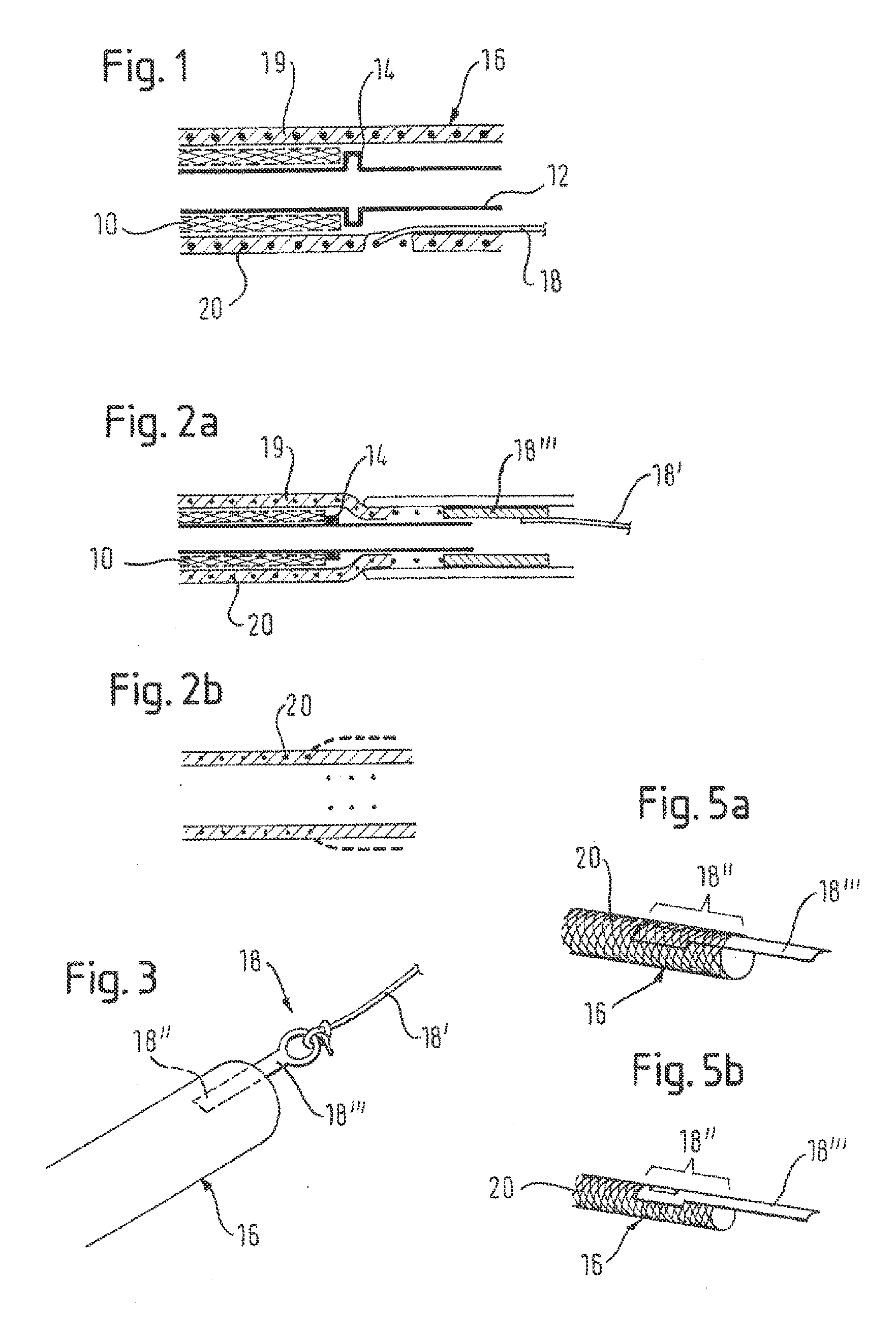 Retractable catheter