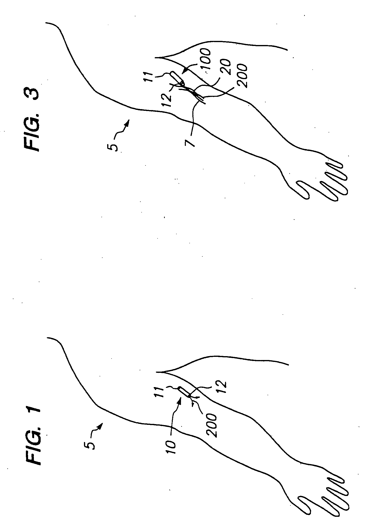 Devices and methods for pain management