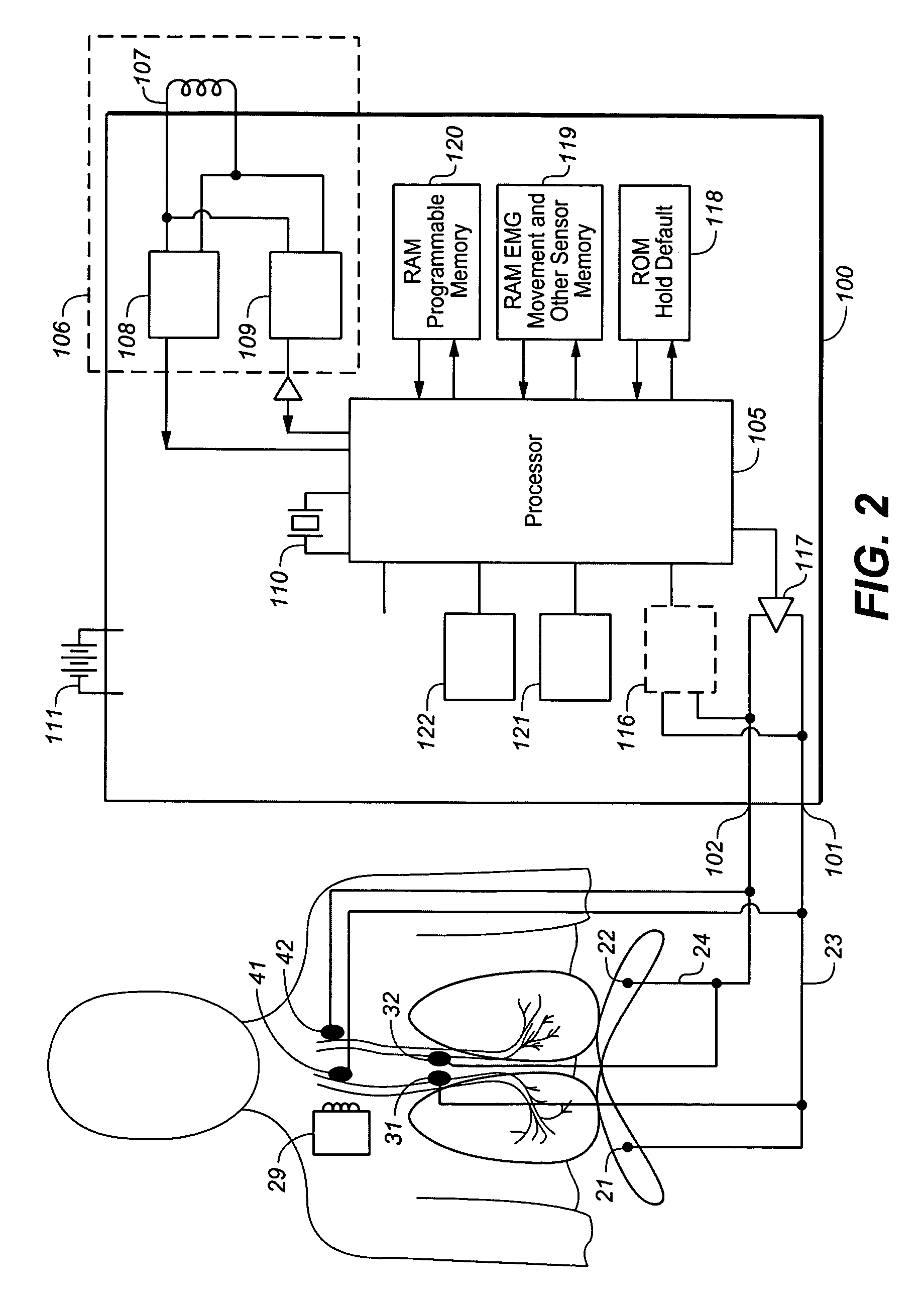 Device and method for manipulating exhalation