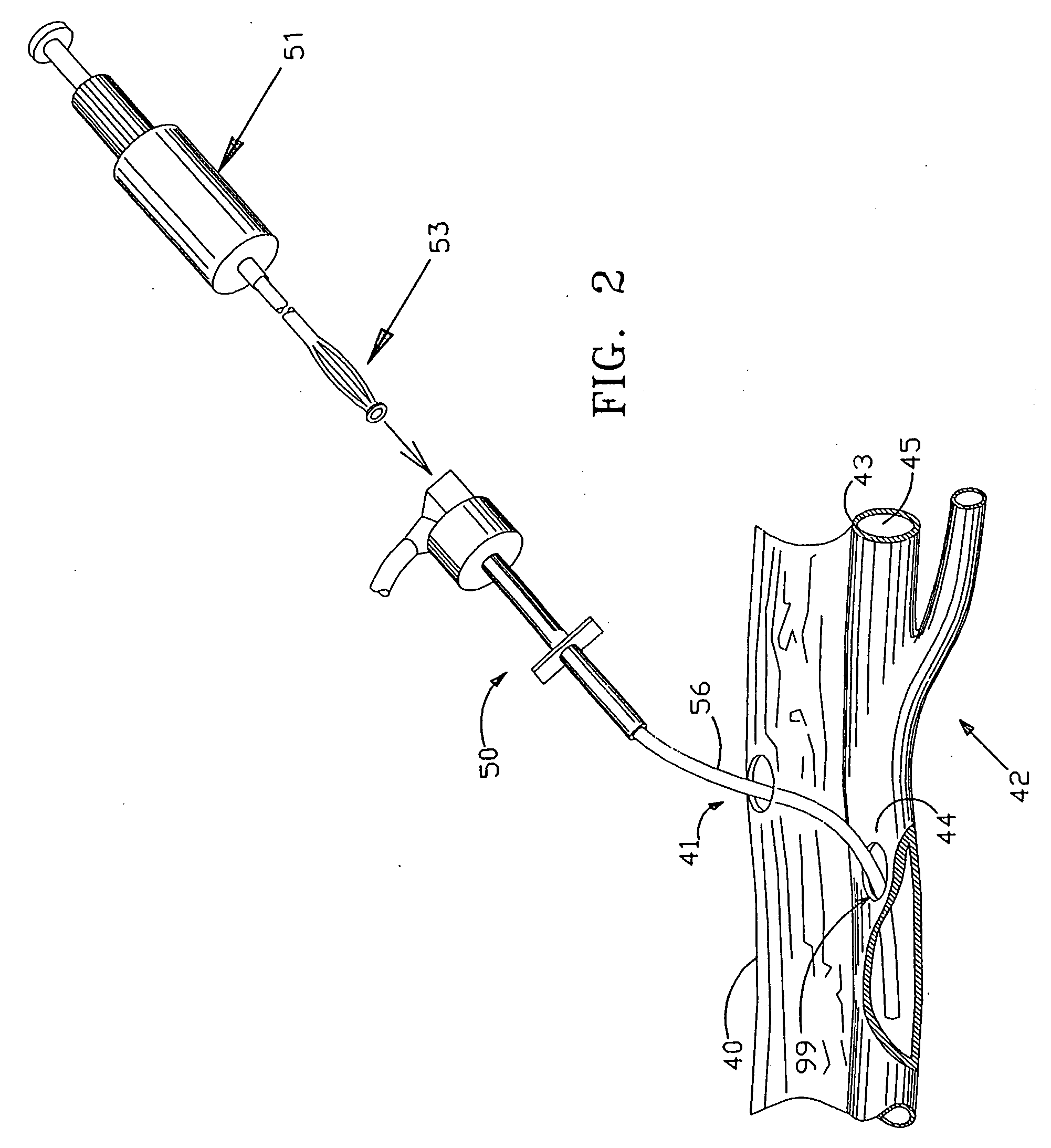 Apparatus and method for positive closure of an internal tissue membrane opening