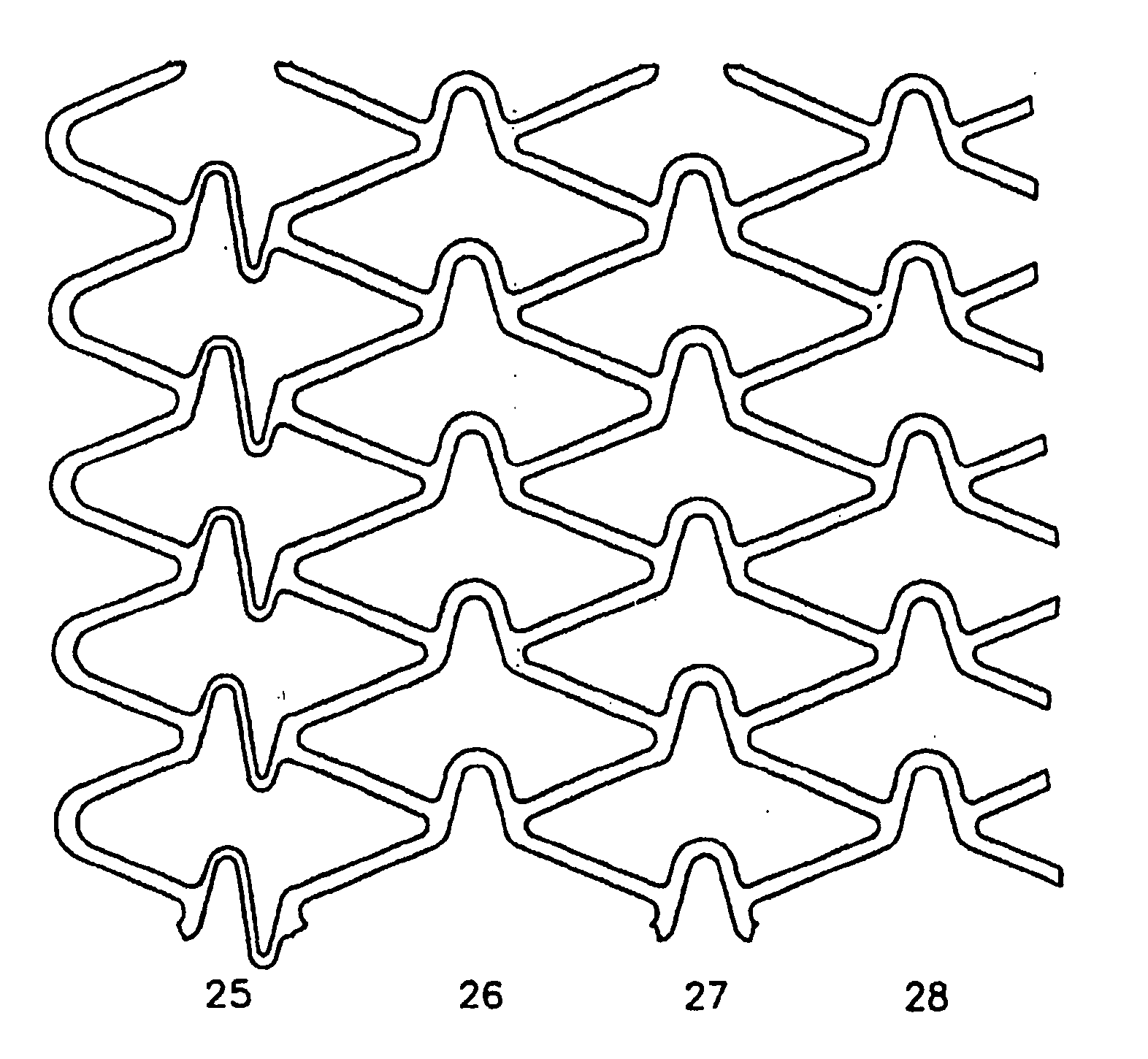 Stent with variable features to optimize support and method of making such stent