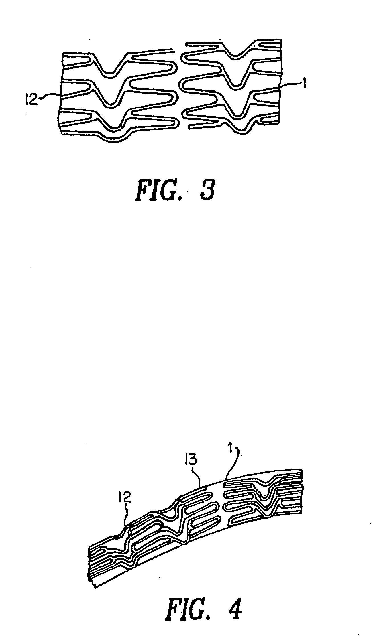 Stent with variable features to optimize support and method of making such stent