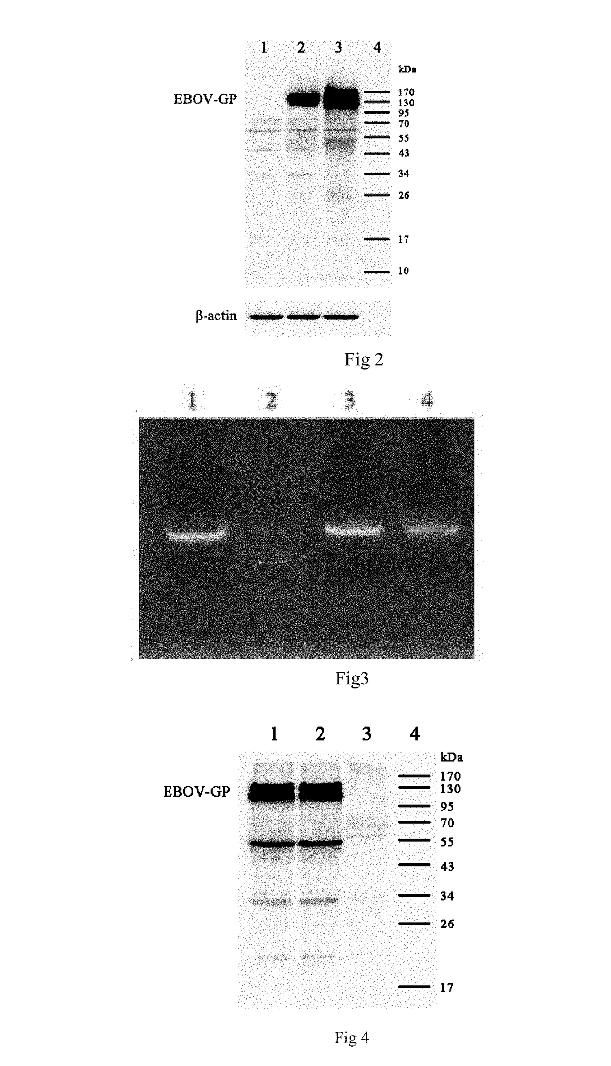 Ebola virus disease vaccine taking human replication deficient adenovirus as vector