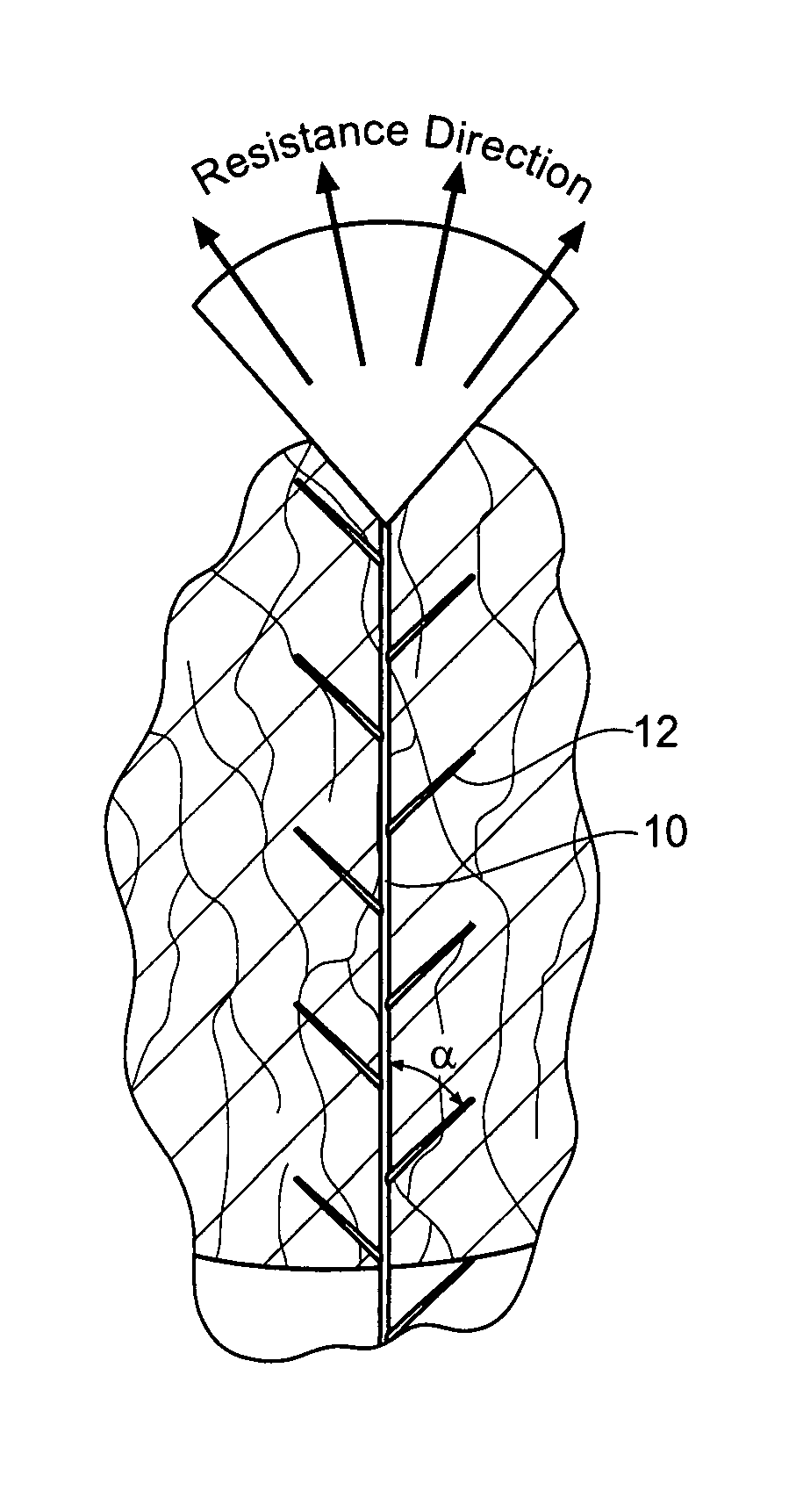 Implantable devices, systems, and methods for maintaining desired orientations in targeted tissue regions