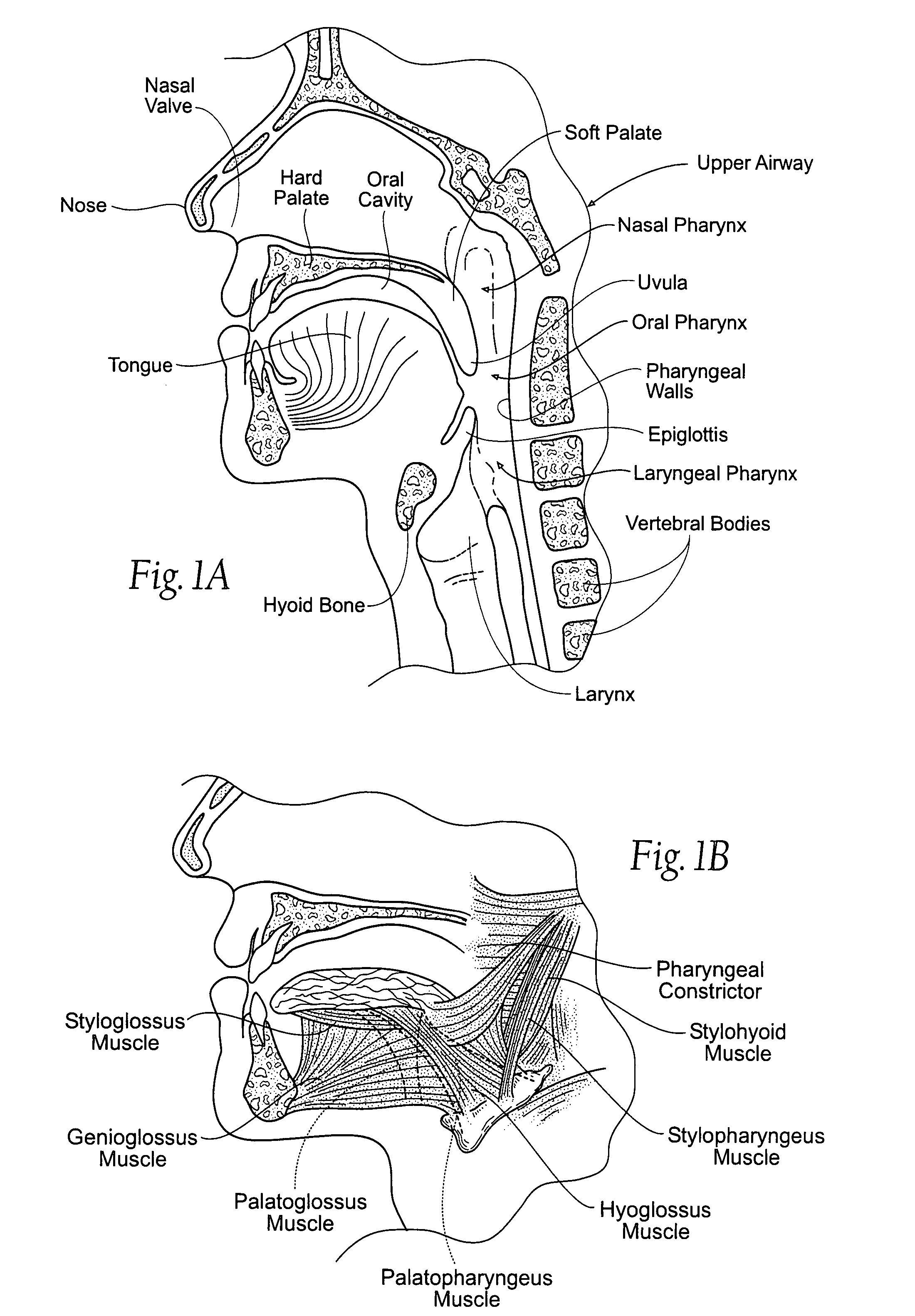 Implantable devices, systems, and methods for maintaining desired orientations in targeted tissue regions